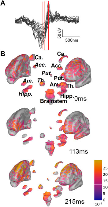 Global and non-Global slow oscillations differentiate in their depth profiles